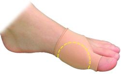 Bunion Bedder,Shield, Regulator Large * X-Large 1/Pk * 3mm soft flexible foot pad for protecting bunions by absorbing shock and shear forces, designed to fit comfortably in dress shoes * Soft stretch-fabric cover comfortably
positions gel pad over painful bunions (hallux joint) * Uncovered version allows mineral oil gel to soften and comfort painful and sensitive bunions (hallux joint) through direct contact with skin * Secures comfortably over the big toe and around the foot to prevent sliding * Washable and reusable *