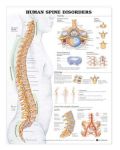Human Spine Disorders Anatomical Chart 20